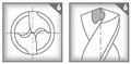 Macanoform élezés