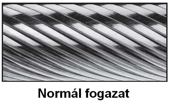 normál fogazat
